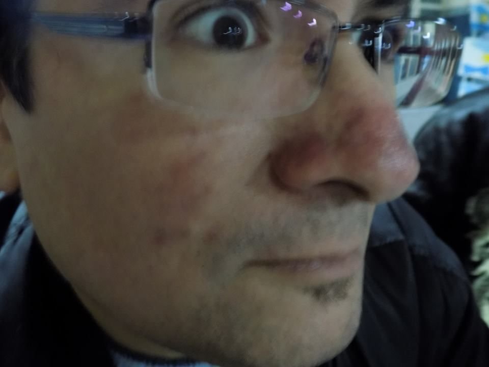 Sorprendido