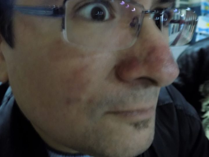 Sorprendido